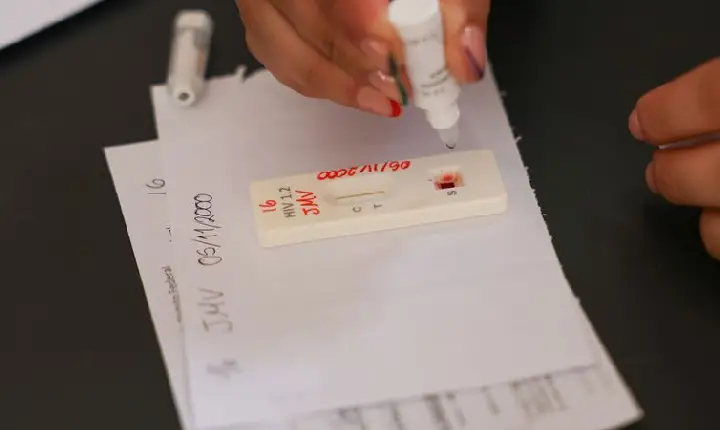 Ação no DF oferece testagem rápida e informação sobre HIV/Aids