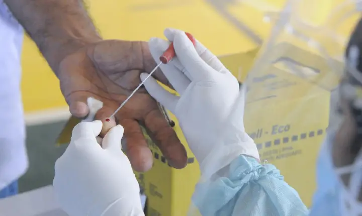 Brasil apresenta baixa testagem de Covid-19, desde o início da pandemia