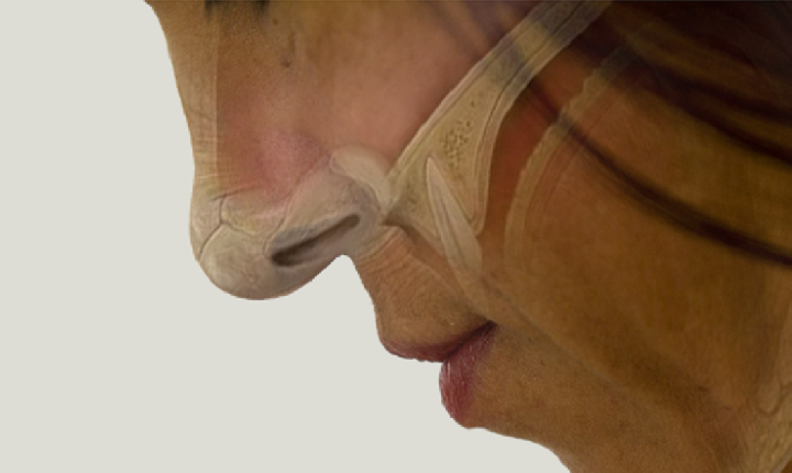 Hospital Universitário de Sergipe tem cirurgia pioneira para tratar perda de olfato causada pela Covid-19