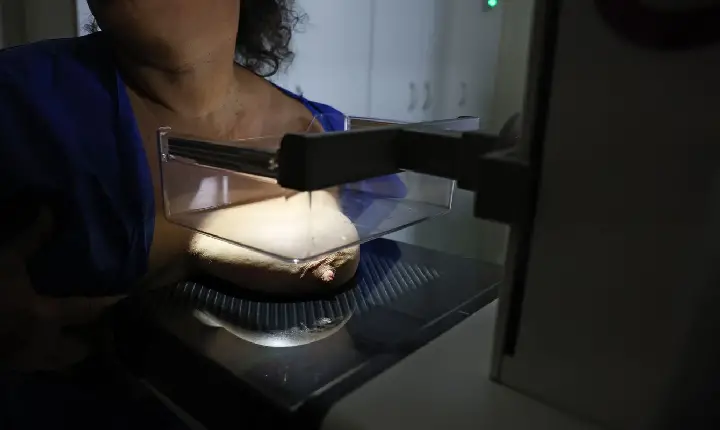 Vigitel: 92% das brasileiras entre 50 e 69 anos fizeram mamografia