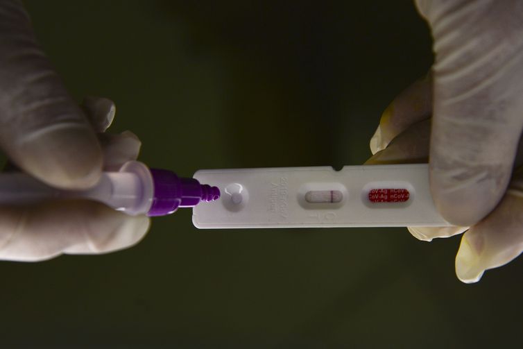 Brasil registra 27.796 casos e 114 mortes em 24 horas