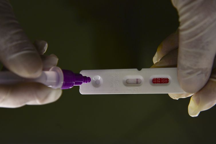 Pesquisadores identificam método capaz de prever gravidade da covid-19